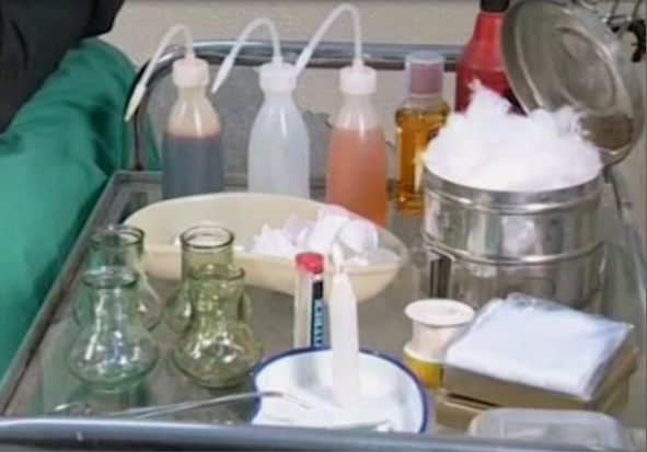 ما هية عملية الحجامة ووصفها